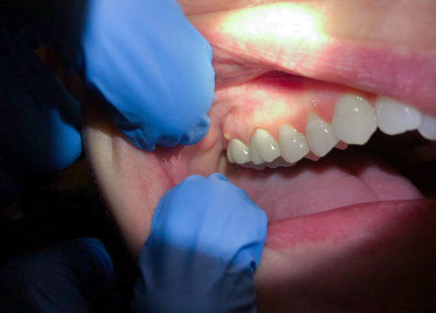 Best Teeth Whitening  in Dillingham, AK